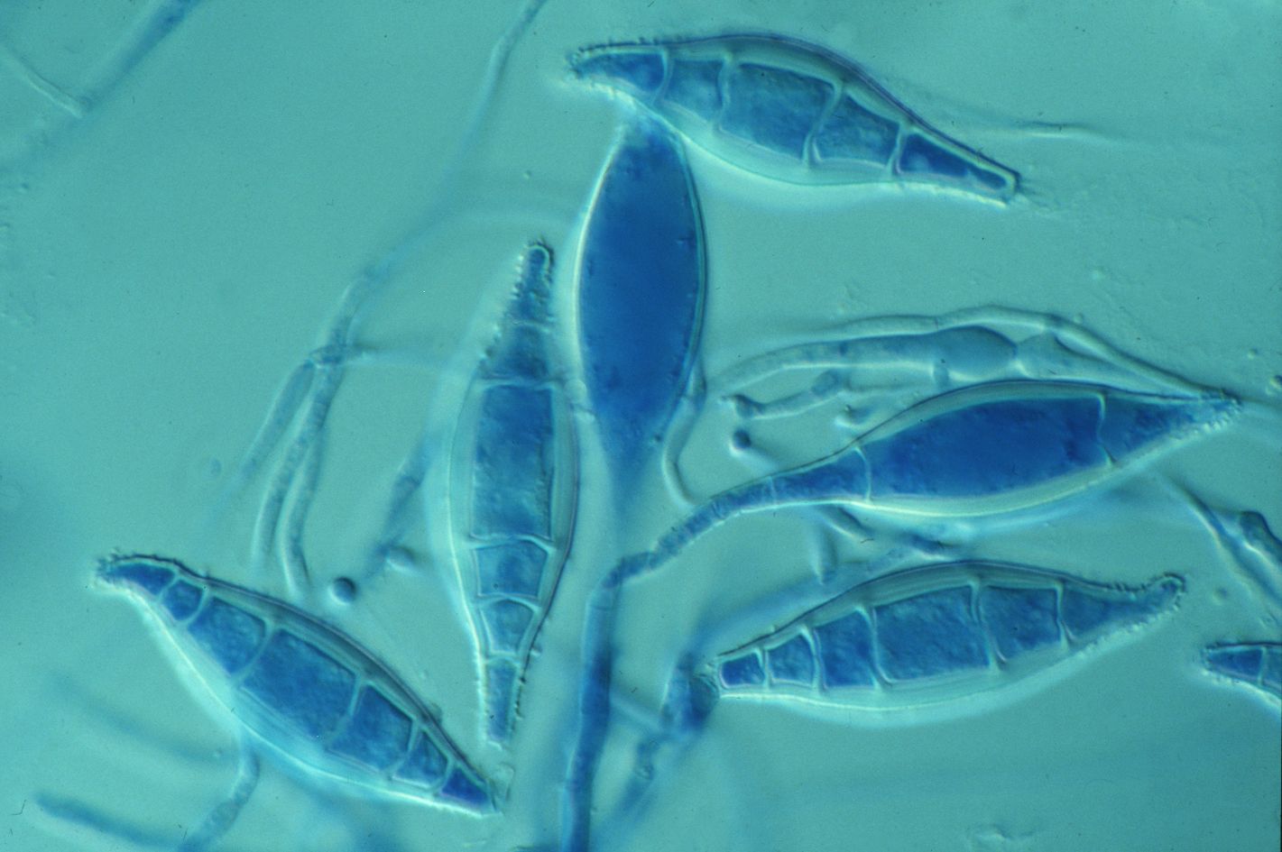 Pilze und Kulturpräparat von Microsporum canis