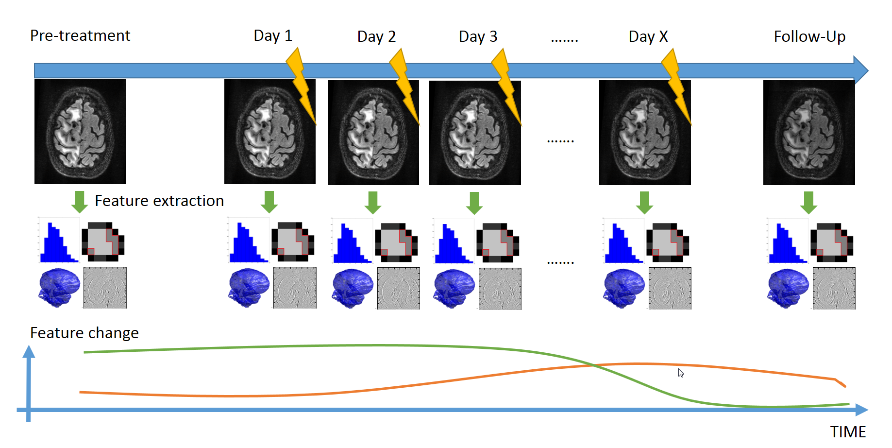 MRI Bilder