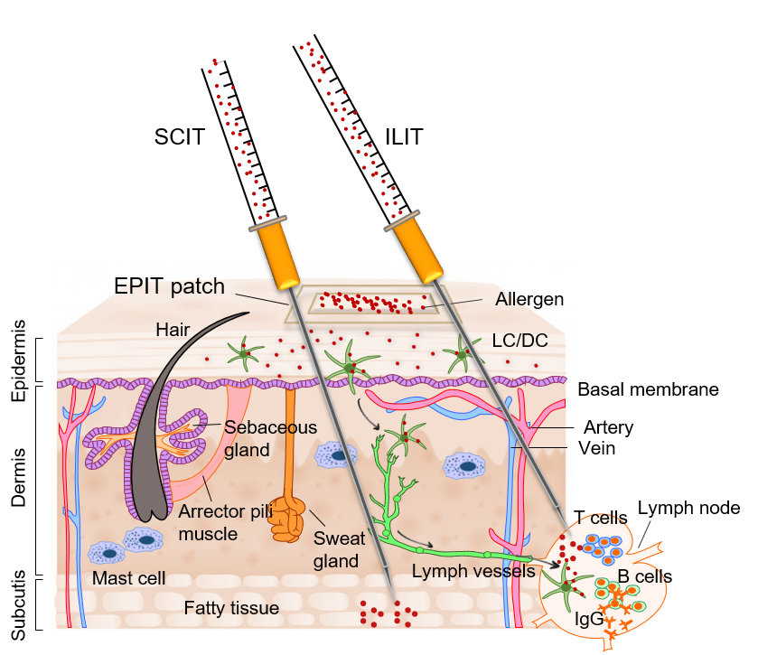 Grafik zur Veranschaulichung von einer Immuntherapie