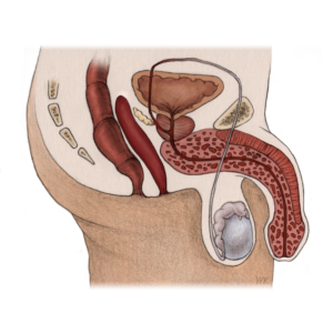 Illustration eines Querschnitts durch die Beckenregion des Mannes