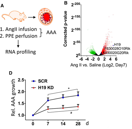 Abbildung. Nicht-codierende RNA H19 ist überexprimiert in AAA.