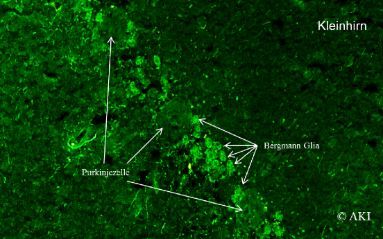 Anti SOX Fluoreszenzaufnahme