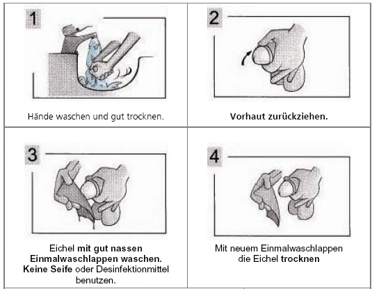 Gewinnung von Mittelstrahlurin bei Männern