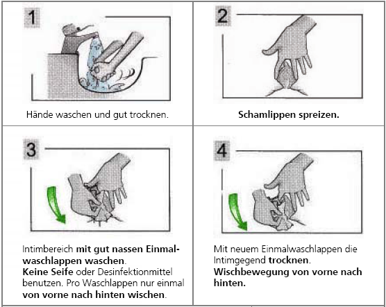 Gewinnung von Mittelstrahlurin bei Frauen