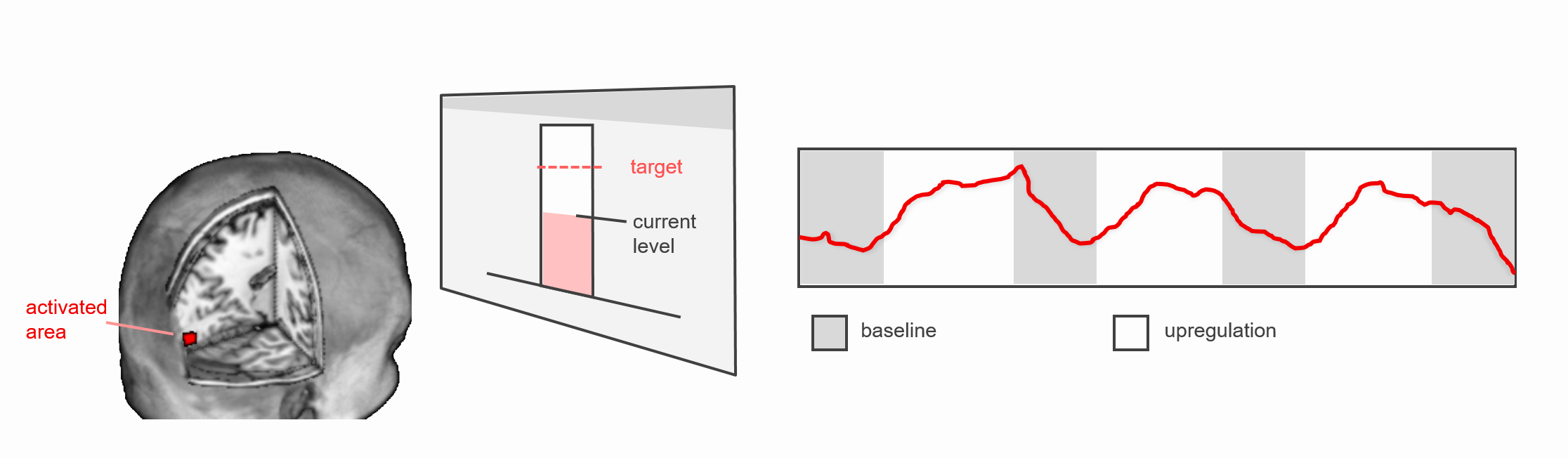 Neurofeedback Diagramm