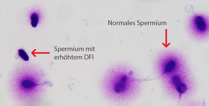 DNA Fragmentations-Test