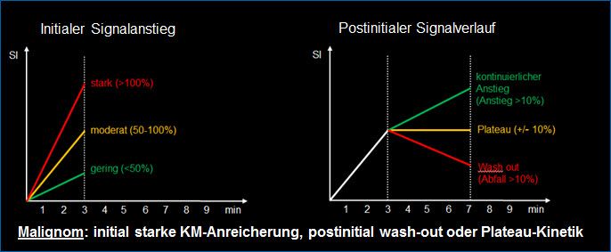 Beurteilung MRI Diagramm