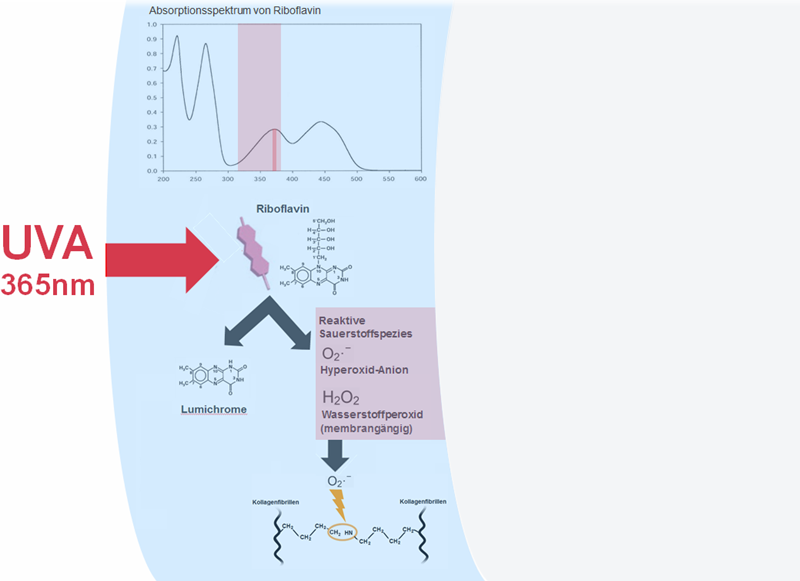 Riboflavin-UVA-Kollagen-Crosslinking der Hornhaut