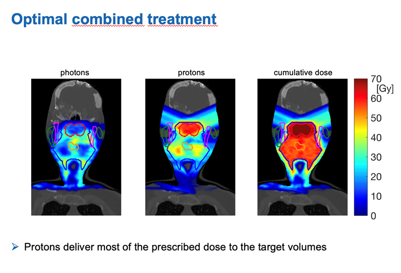 Abbildung Dissertation zum Thema Kombinierte Photonen-Protonen-Therapie