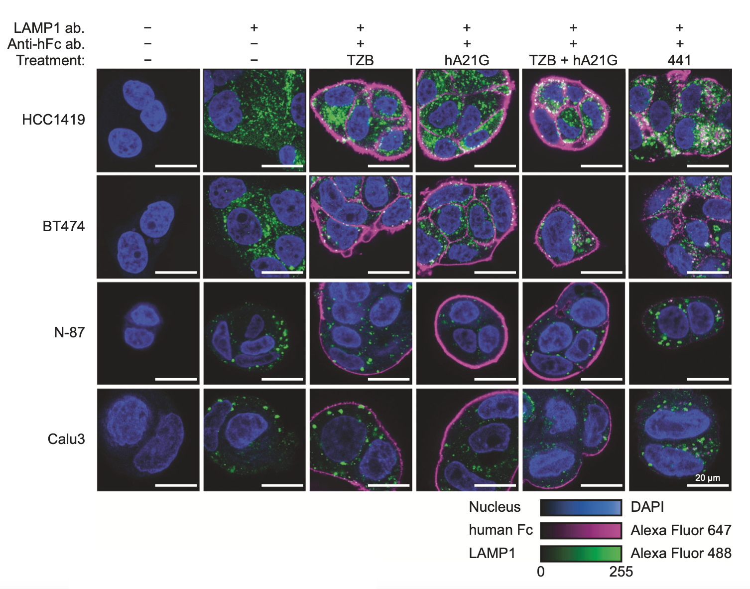 The engineered bi-paratopic antibody termed "441" induces internalization and degradation in HER2-overexpressing cell lines, while all controls do not. This is seen by the disappearance of the continuous staining (magenta) on the outside, and the appearance of punctate staining in lysosomes (green). This effect is only seen with this particular specially engineered biparatopic construct, while other similar antibodies do not show this. Because of this unique effectivity in tumor xenografts, the antibody is now further developed for clinical trials.